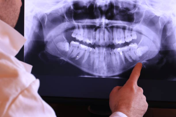 Best Emergency Dentist Near Me  in Forsyth, GA