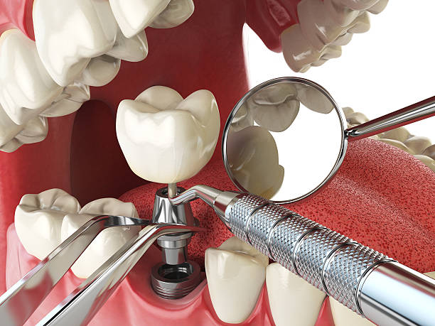 Best Tooth Pain Emergency Relief  in Forsyth, GA